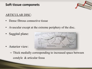 Soft tissue componets 
ARTICULAR DISC: 
• Dense fibrous connective tissue 
• Avascular except at the extreme periphery of the disc. 
• Saggital plane: 
• Anterior view: 
– Thick medially corresponding to increased space between 
condyle & articular fossa 
 