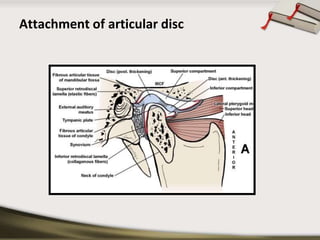 Attachment of articular disc 
 