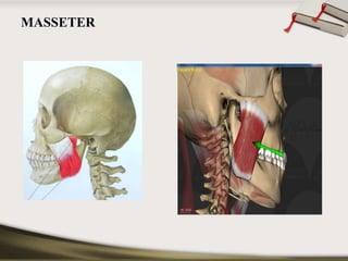 MASSETER 
 