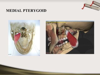 MEDIAL PTERYGOID 
 