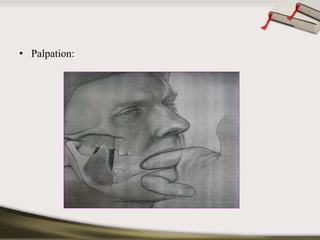• Palpation: 
 