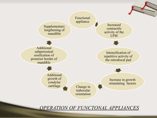 Functional 
appliance 
Increased 
contractile 
activity of the 
LPM 
Intensification of 
repetitive activity of 
the retrodiscal pad 
Increase in growth 
stimulating factors 
Change in 
trabecular 
orientation 
Supplementary 
lengthening of 
mandible 
Additional 
subperiosteal 
ossification of 
posterior border of 
mandible 
Additional 
growth of 
condylar 
cartilage 
OPERATION OF FUNCTONAL APPLIANCES 
 