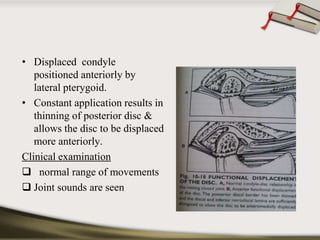 • Displaced condyle 
positioned anteriorly by 
lateral pterygoid. 
• Constant application results in 
thinning of posterior disc & 
allows the disc to be displaced 
more anteriorly. 
Clinical examination 
 normal range of movements 
 Joint sounds are seen 
 