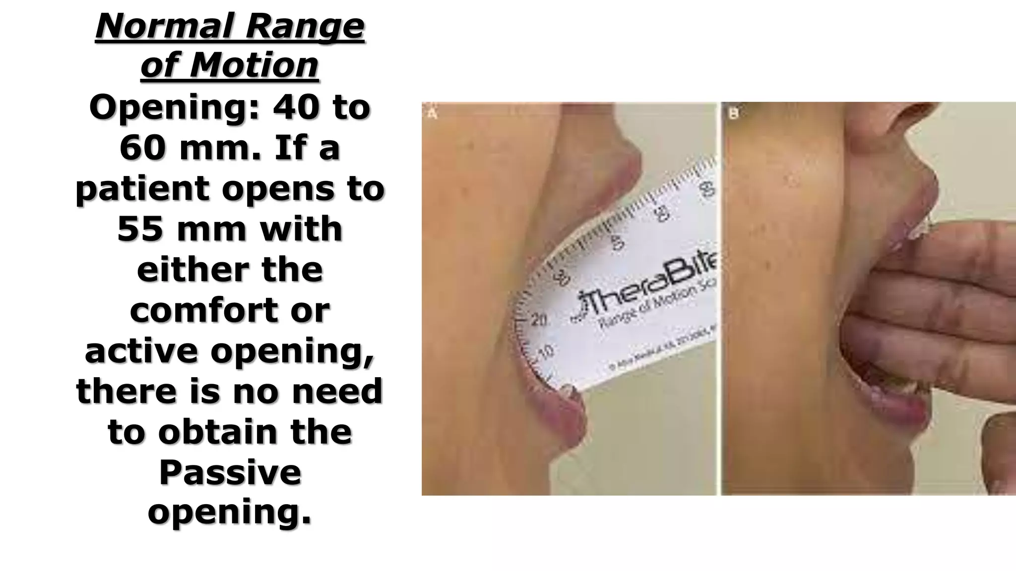 TMJ MOTION MEASUREMENTS | PPTX