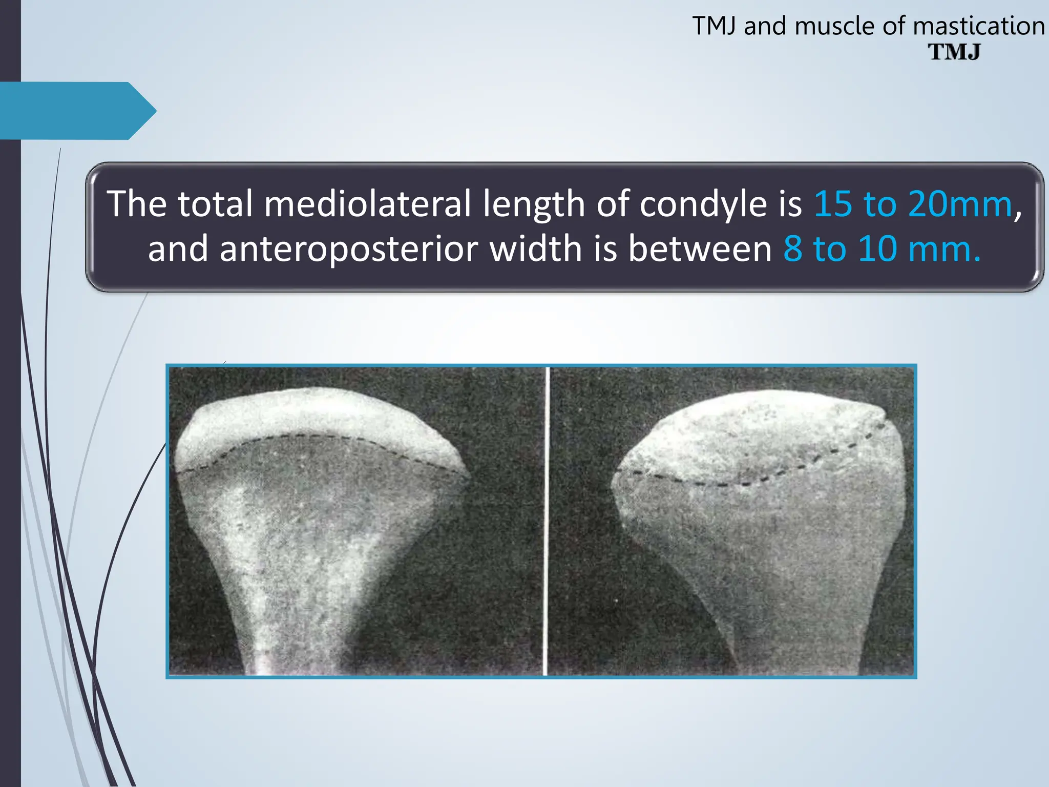 Temporomandibular joint Muscles of Mastication | PPT