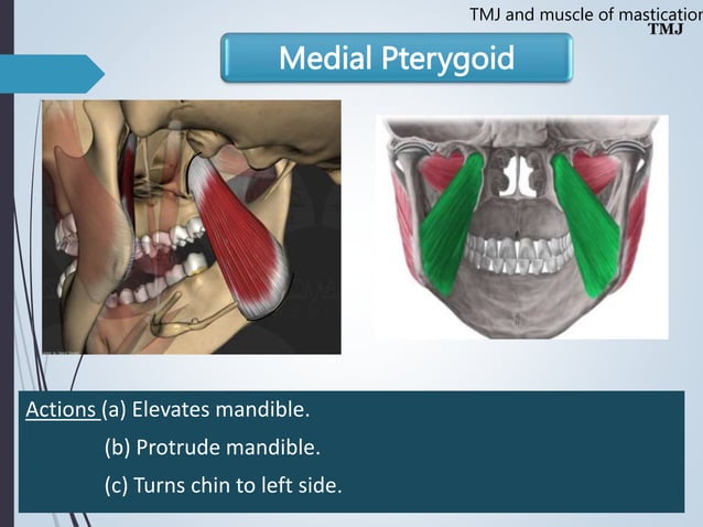 Temporomandibular joint Muscles of Mastication | PPT