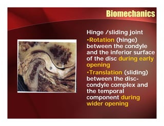 Biomechanics

Hinge /sliding joint
•Rotation (hinge)
between the condyle
and the inferior surface
of the disc during early
opening
•Translation ( lidi )
 T     l ti  (sliding)
between the disc-
co dy e complex and
condyle co p e a d
the temporal
component during
wider opening
 