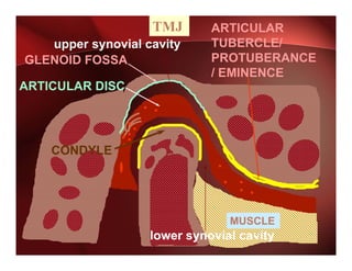 TMJ       ARTICULAR
   upper synovial cavity
    pp    y            y     TUBERCLE/
GLENOID FOSSA                PROTUBERANCE
                             / EMINENCE
ARTICULAR DISC




    CONDYLE




                                MUSCLE
                   lower synovial cavity
 