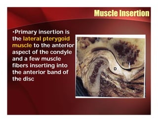 Muscle Insertion

•Primary insertion is
the lateral pterygoid
muscle to the anterior
aspect of the condyle
and a few muscle
fibers inserting into
the anterior band of
the disc
 