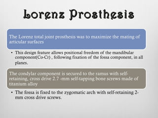 Lorenz ProsthesisLorenz Prosthesis
 