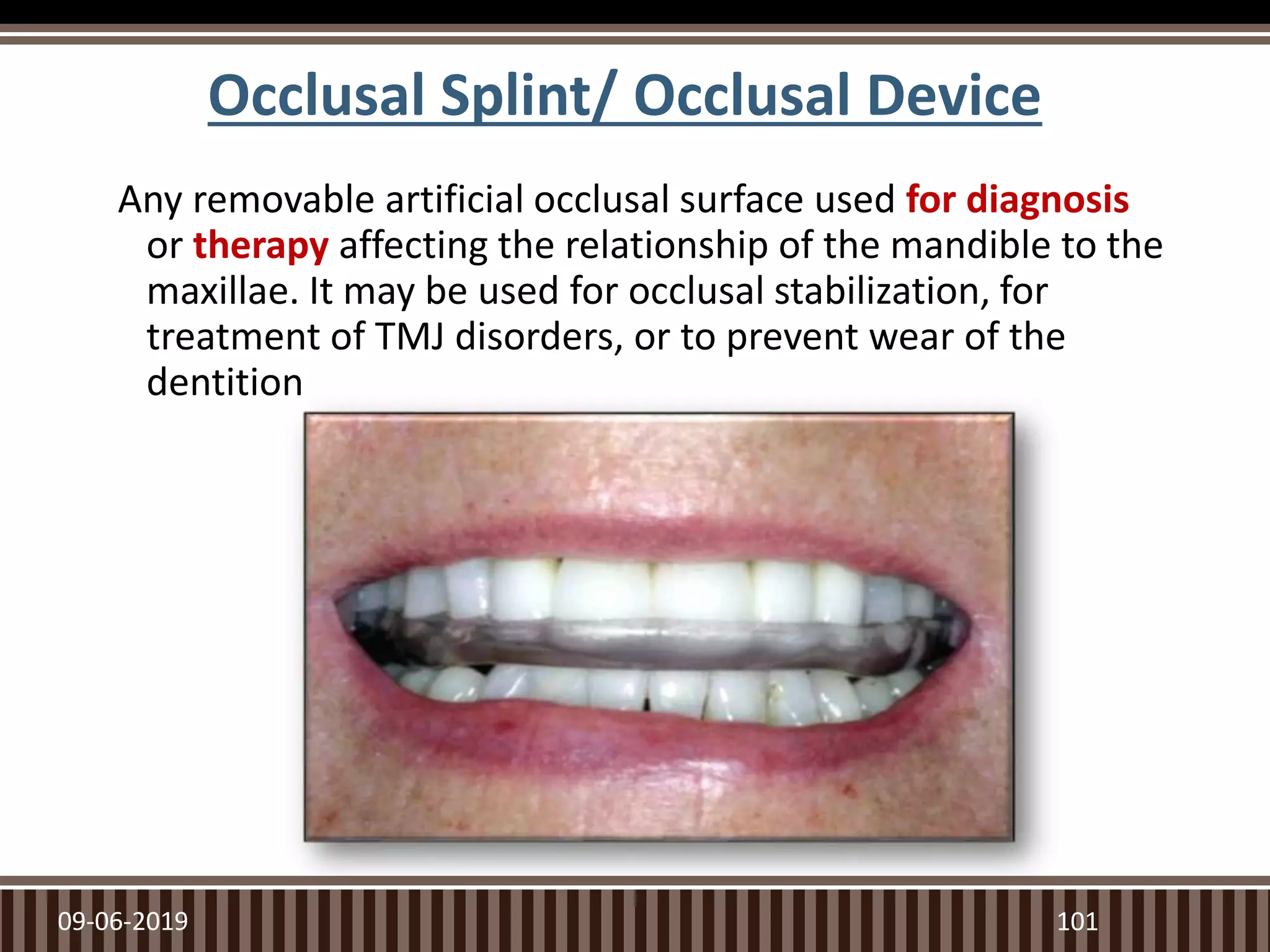 Occlusal Splint/ Occlusal Device
Any removable artificial occlusal surface used for diagnosis
or therapy affecting the relationship of the mandible to the
maxillae. It may be used for occlusal stabilization, for
treatment of TMJ disorders, or to prevent wear of the
dentition
09-06-2019 101
 