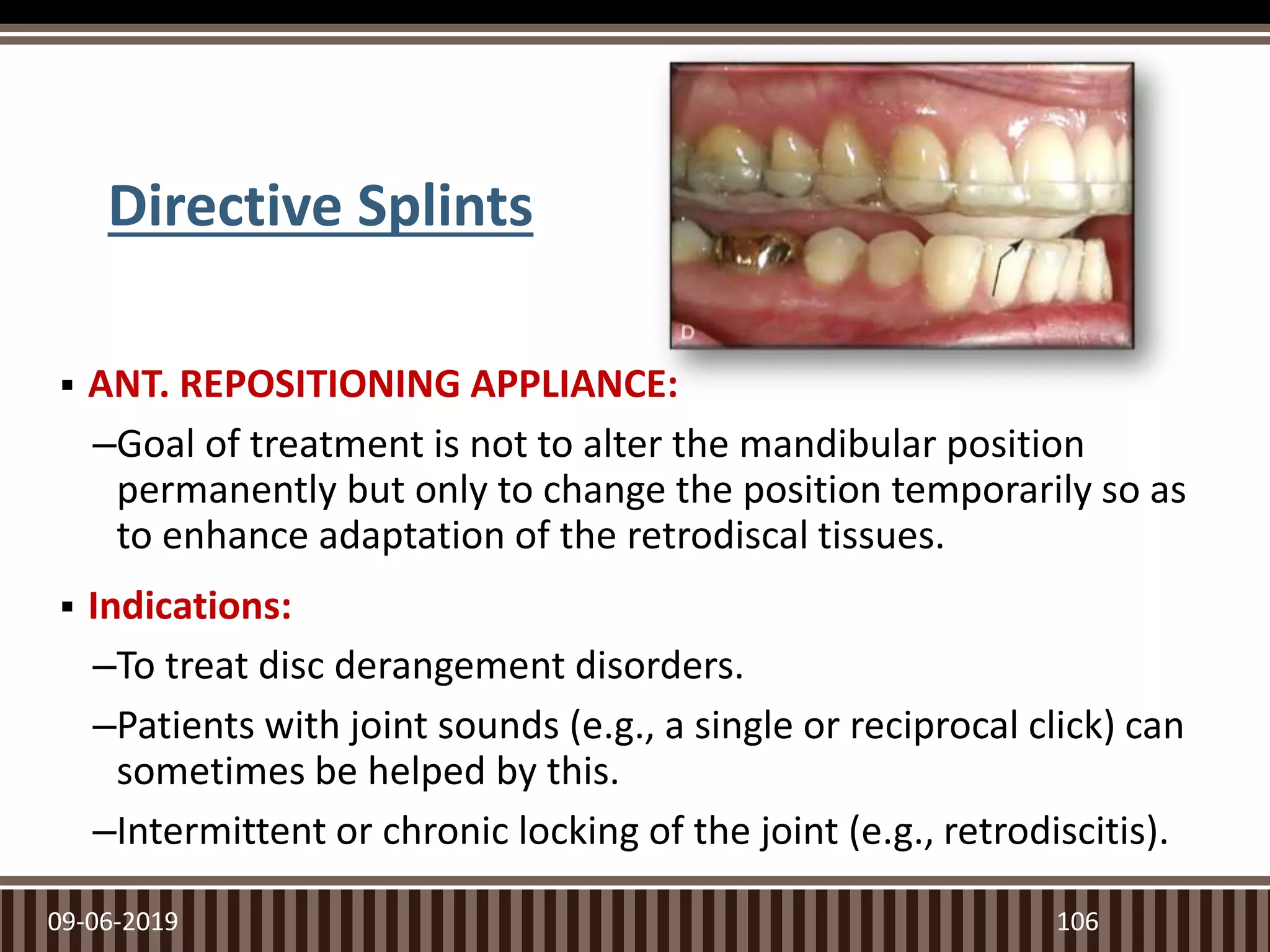 Directive Splints
 ANT. REPOSITIONING APPLIANCE:
–Goal of treatment is not to alter the mandibular position
permanently but only to change the position temporarily so as
to enhance adaptation of the retrodiscal tissues.
 Indications:
–To treat disc derangement disorders.
–Patients with joint sounds (e.g., a single or reciprocal click) can
sometimes be helped by this.
–Intermittent or chronic locking of the joint (e.g., retrodiscitis).
09-06-2019 106
 