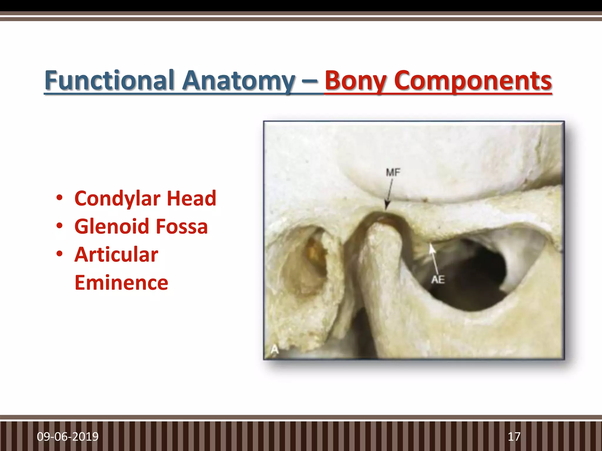 Functional Anatomy – Bony Components
09-06-2019 17
• Condylar Head
• Glenoid Fossa
• Articular
Eminence
 