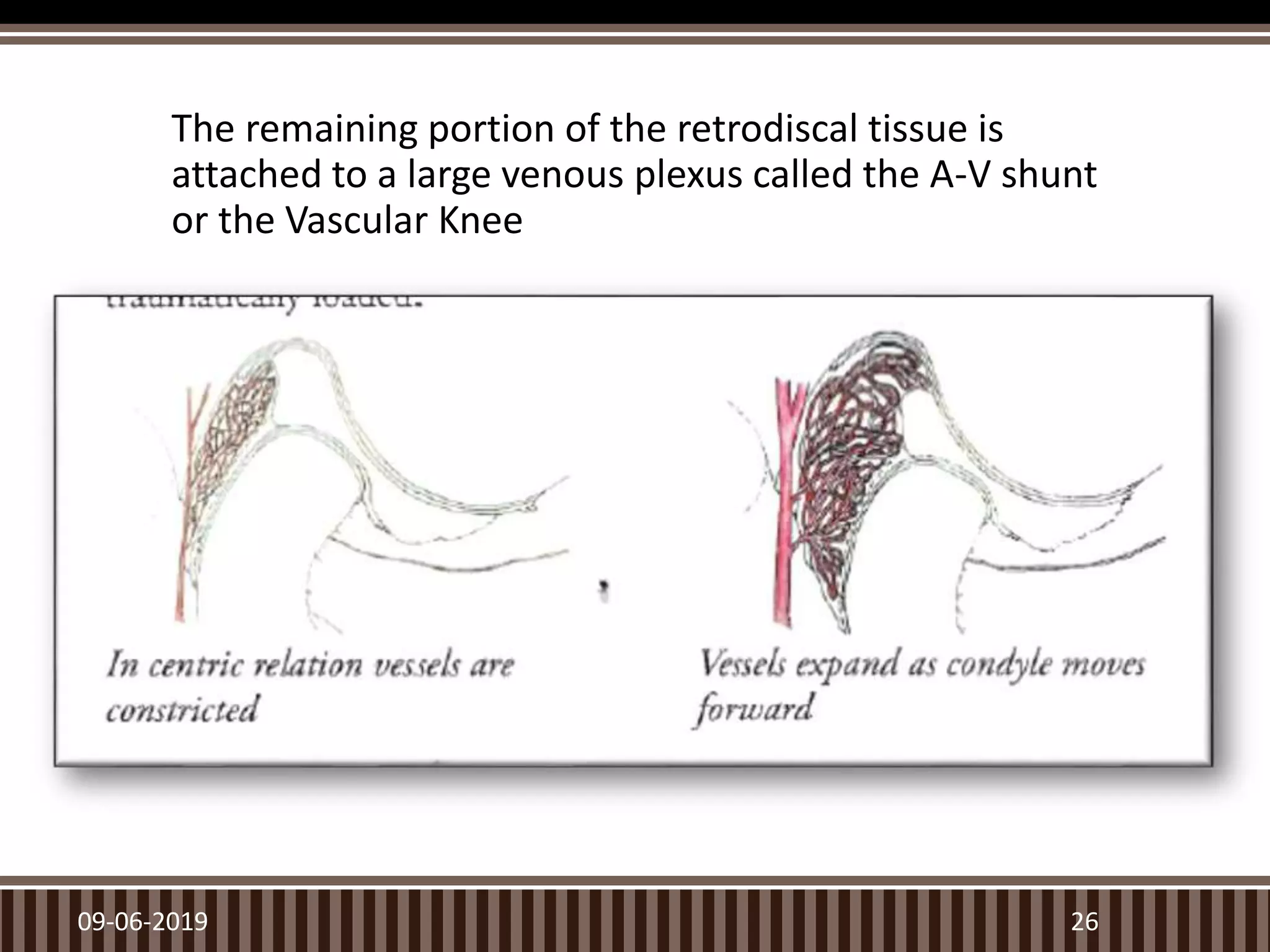 The remaining portion of the retrodiscal tissue is
attached to a large venous plexus called the A-V shunt
or the Vascular Knee
09-06-2019 26
 