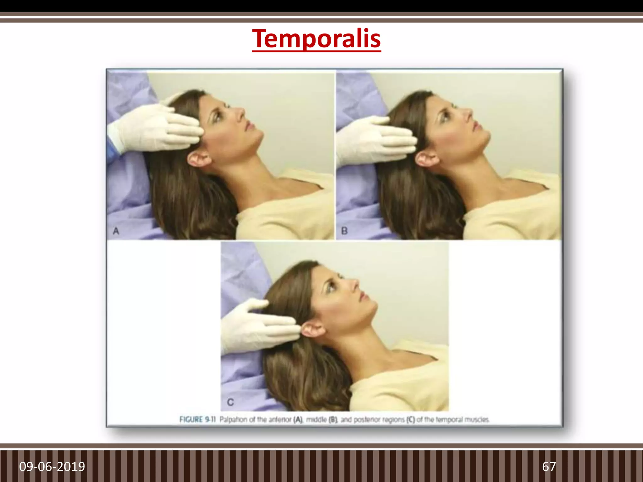 Temporalis
09-06-2019 67
 