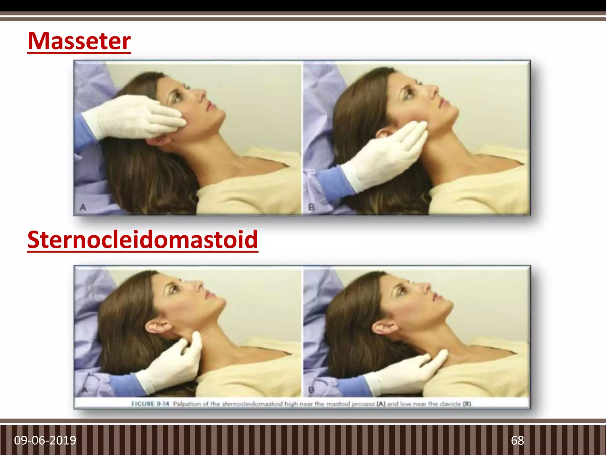Masseter
09-06-2019 68
Sternocleidomastoid
 