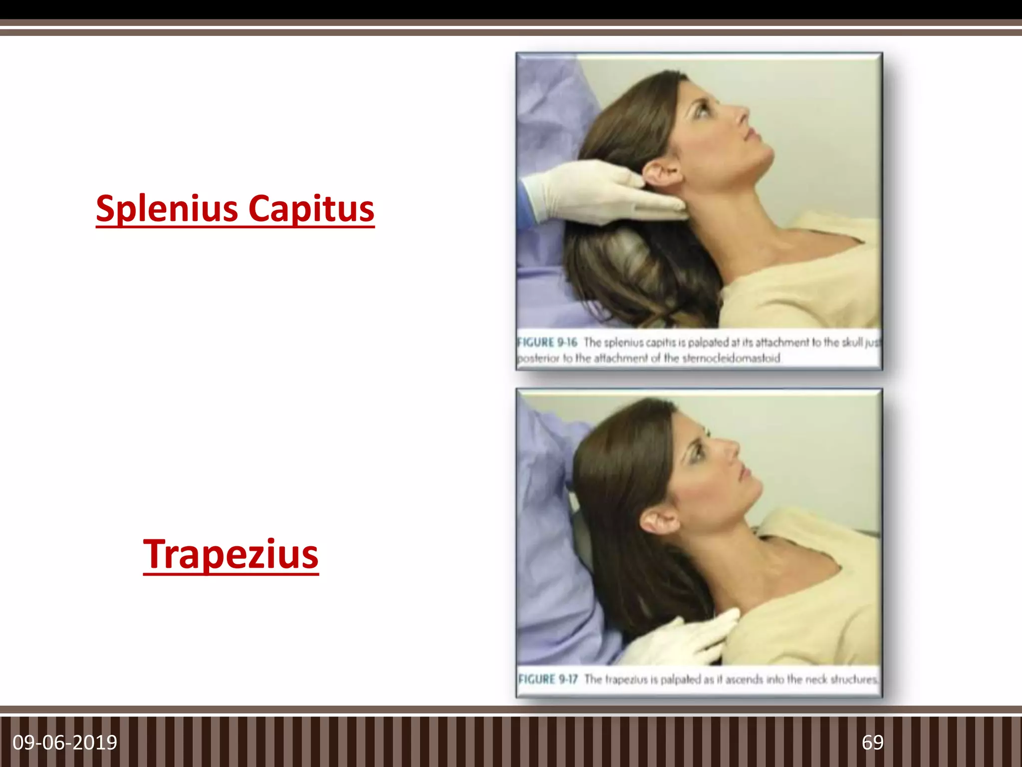 Splenius Capitus
09-06-2019 69
Trapezius
 