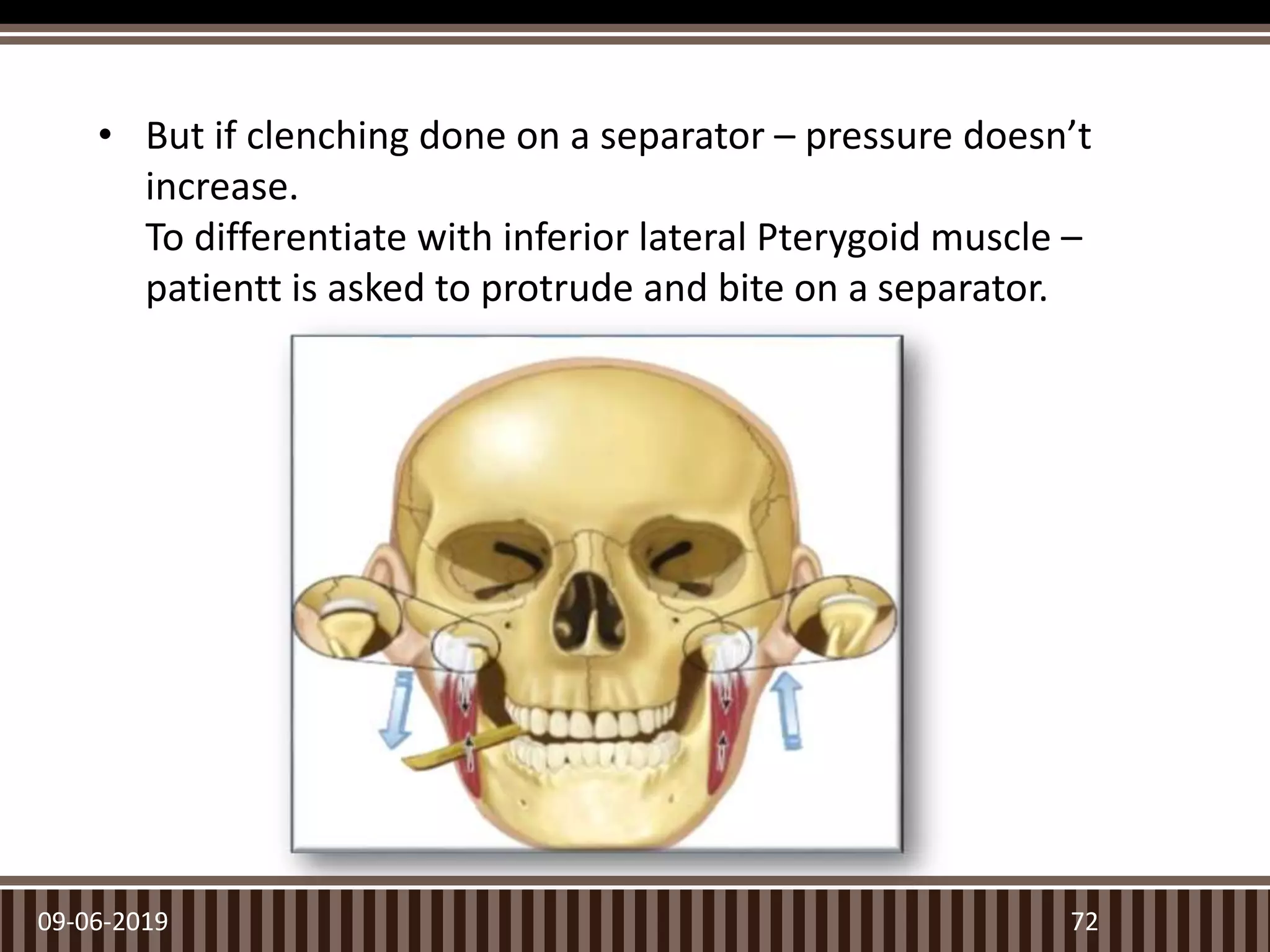 • But if clenching done on a separator – pressure doesn’t
increase.
To differentiate with inferior lateral Pterygoid muscle –
patientt is asked to protrude and bite on a separator.
09-06-2019 72
 
