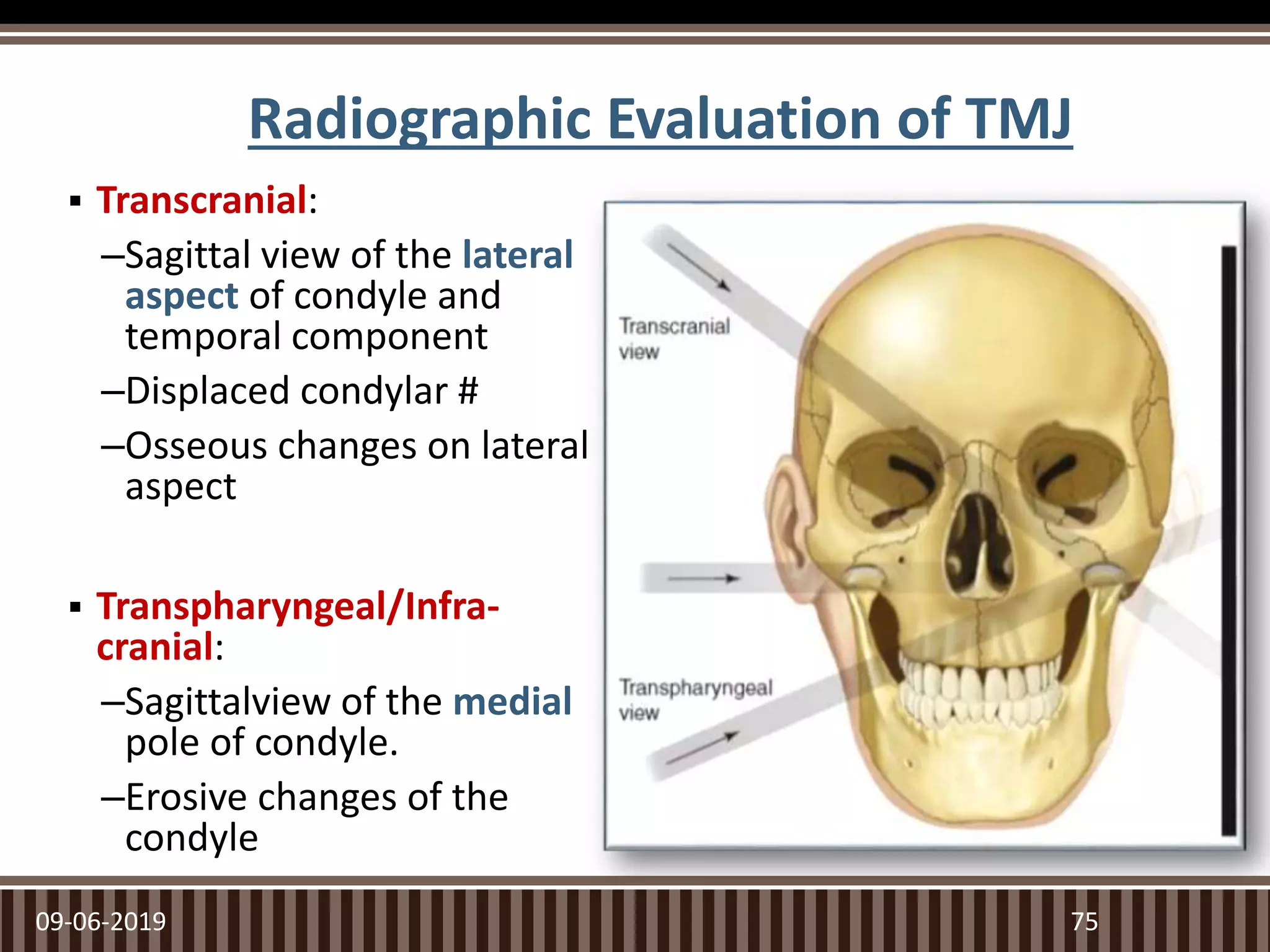 Radiographic Evaluation of TMJ
 Transcranial:
–Sagittal view of the lateral
aspect of condyle and
temporal component
–Displaced condylar #
–Osseous changes on lateral
aspect
 Transpharyngeal/Infra-
cranial:
–Sagittalview of the medial
pole of condyle.
–Erosive changes of the
condyle
09-06-2019 75
 