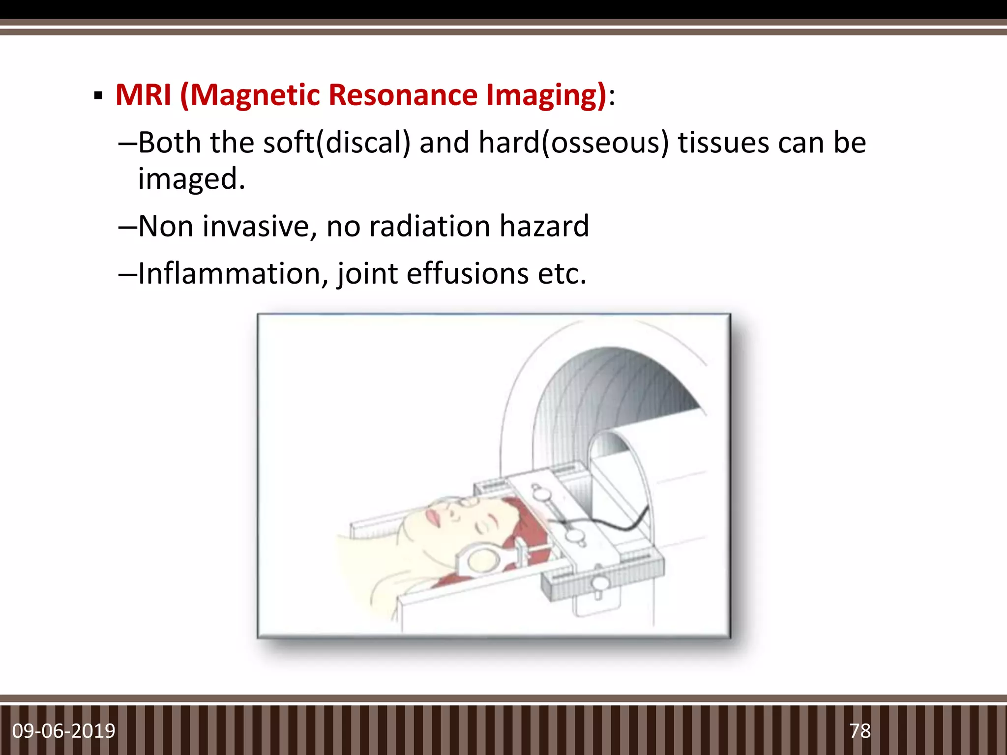  MRI (Magnetic Resonance Imaging):
–Both the soft(discal) and hard(osseous) tissues can be
imaged.
–Non invasive, no radiation hazard
–Inflammation, joint effusions etc.
09-06-2019 78
 