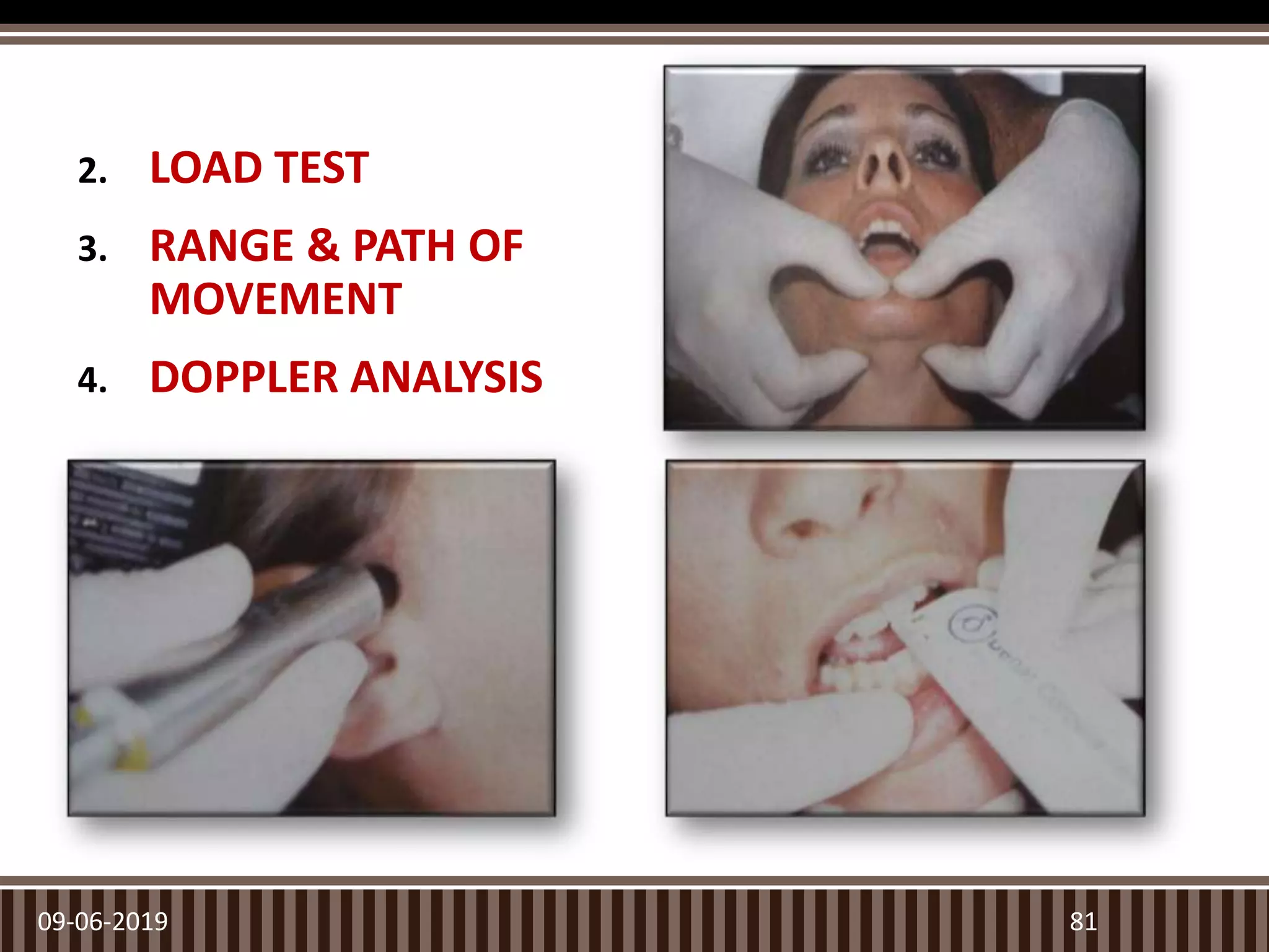 2. LOAD TEST
3. RANGE & PATH OF
MOVEMENT
4. DOPPLER ANALYSIS
09-06-2019 81
 