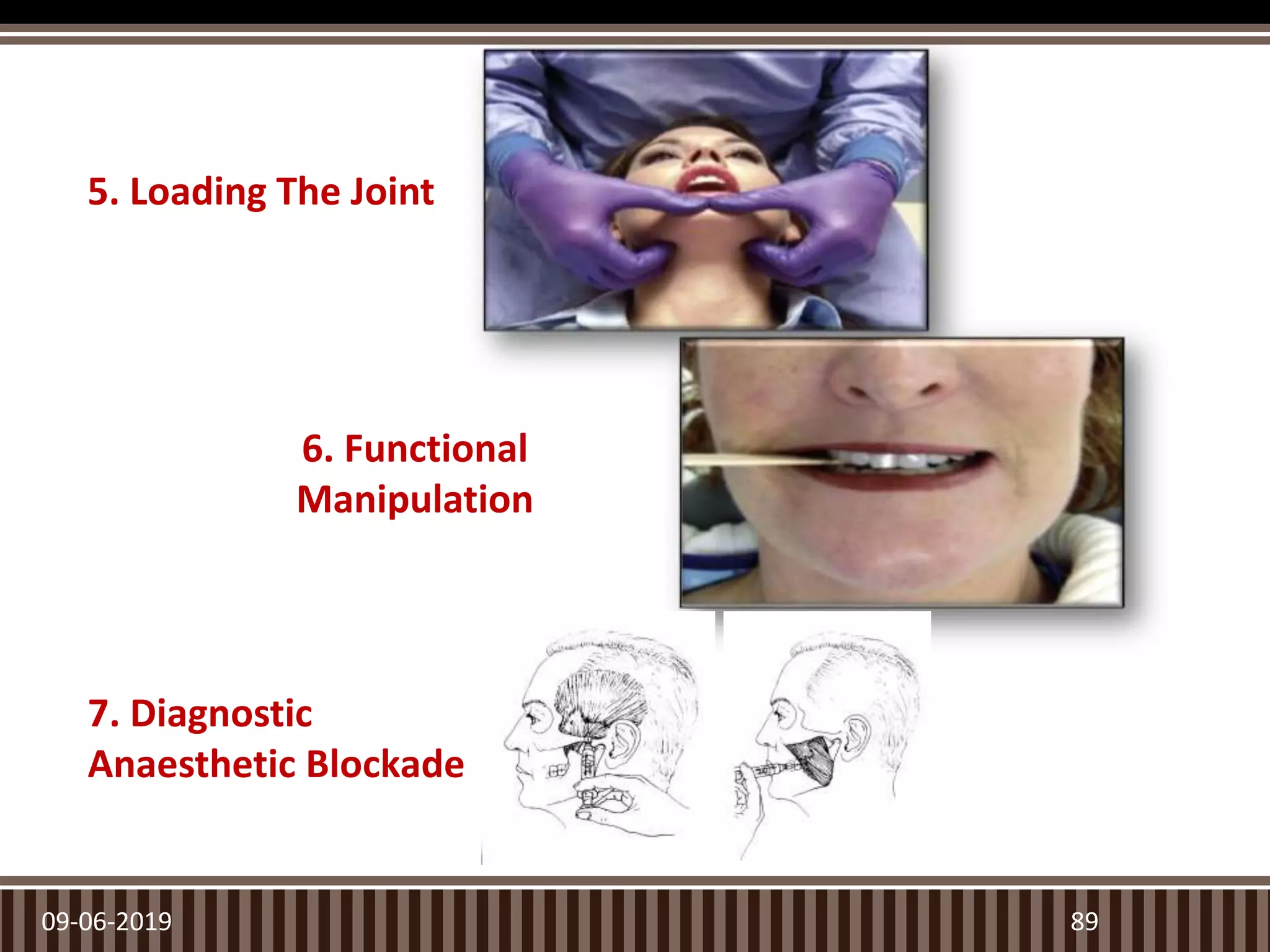 09-06-2019 89
5. Loading The Joint
6. Functional
Manipulation
7. Diagnostic
Anaesthetic Blockade
 