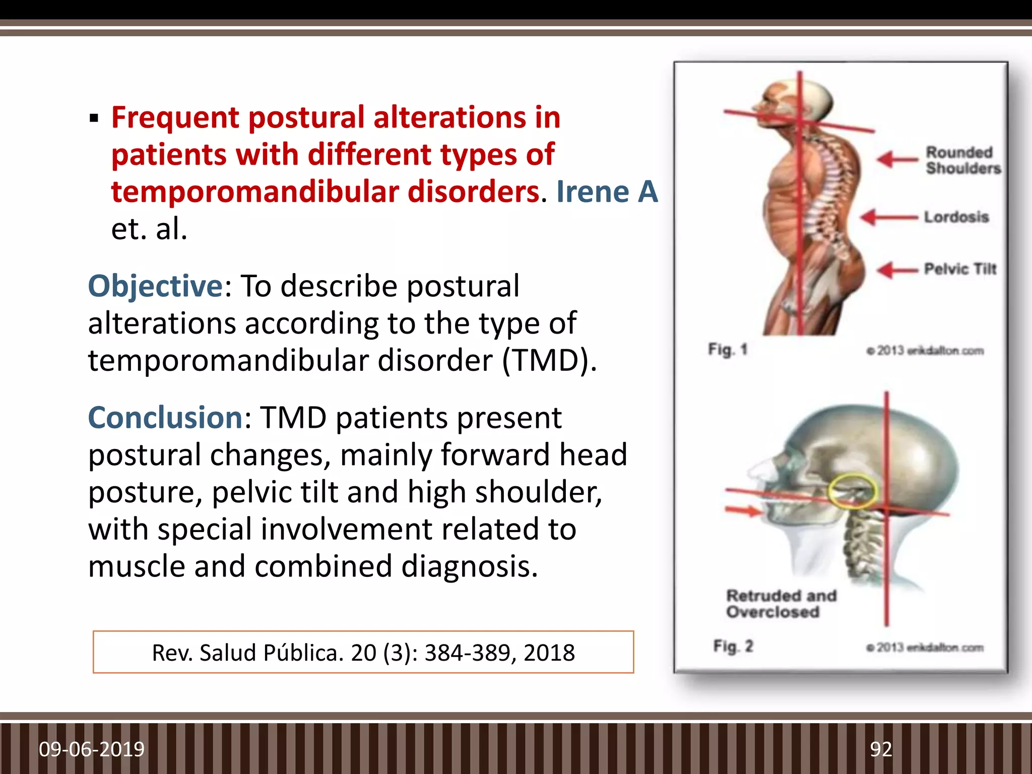  Frequent postural alterations in
patients with different types of
temporomandibular disorders. Irene A
et. al.
Objective: To describe postural
alterations according to the type of
temporomandibular disorder (TMD).
Conclusion: TMD patients present
postural changes, mainly forward head
posture, pelvic tilt and high shoulder,
with special involvement related to
muscle and combined diagnosis.
09-06-2019 92
Rev. Salud Pública. 20 (3): 384-389, 2018
 