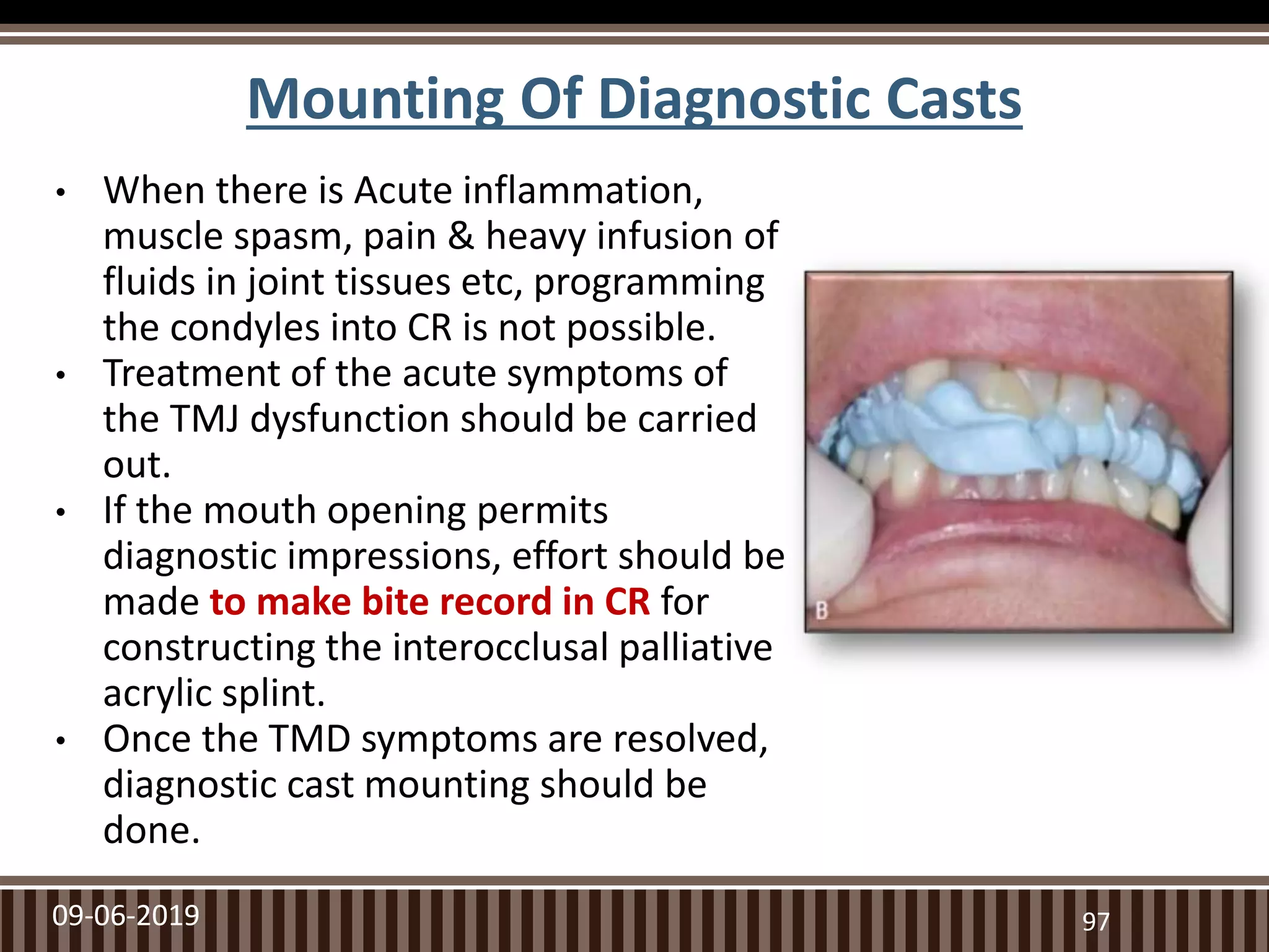 Mounting Of Diagnostic Casts
• When there is Acute inflammation,
muscle spasm, pain & heavy infusion of
fluids in joint tissues etc, programming
the condyles into CR is not possible.
• Treatment of the acute symptoms of
the TMJ dysfunction should be carried
out.
• If the mouth opening permits
diagnostic impressions, effort should be
made to make bite record in CR for
constructing the interocclusal palliative
acrylic splint.
• Once the TMD symptoms are resolved,
diagnostic cast mounting should be
done.
9709-06-2019
 