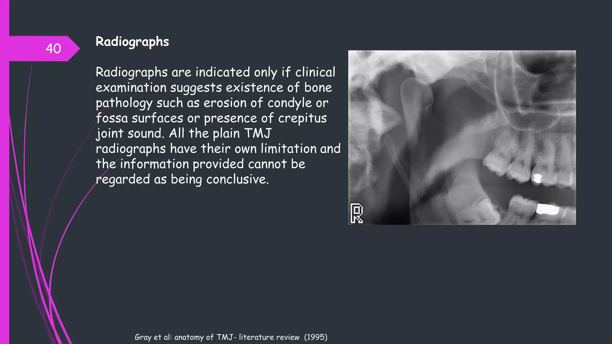Radiographs
Radiographs are indicated only if clinical
examination suggests existence of bone
pathology such as erosion of condyle or
fossa surfaces or presence of crepitus
joint sound. All the plain TMJ
radiographs have their own limitation and
the information provided cannot be
regarded as being conclusive.
40
Gray et al: anatomy of TMJ- literature review (1995)
 