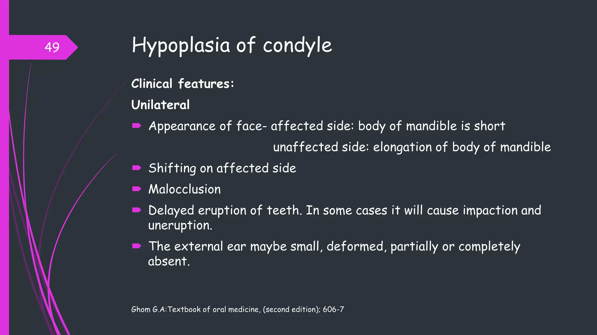 Hypoplasia of condyle
Clinical features:
Unilateral
 Appearance of face- affected side: body of mandible is short
unaffected side: elongation of body of mandible
 Shifting on affected side
 Malocclusion
 Delayed eruption of teeth. In some cases it will cause impaction and
uneruption.
 The external ear maybe small, deformed, partially or completely
absent.
Ghom G.A:Textbook of oral medicine, (second edition); 606-7
49
 