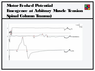 M
otor E
voked P
otential
E
mergence at Arbitrary M
uscle T
ension
Spinal Column T
rauma)

 