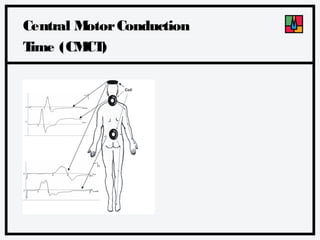 Central M
otor Conduction
T
ime (CM )
CT

 