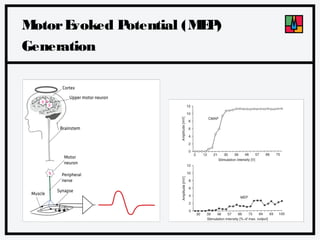 M
otor E
voked P
otential (M P
E)
Generation

 