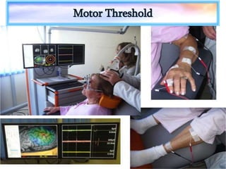 Transcranial Magnetic Stimulation | PPTX