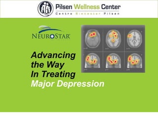 Advancing
the Way
In Treating
Major Depression

 