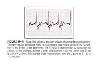 TMT is a test for heart regulation system | PDF