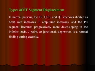 Types of ST Segment Displacement In normal persons, the PR, QRS, and QT intervals shorten as heart rate increases. P amplitude increases, and the PR segment becomes progressively more downsloping in the inferior leads. J point, or junctional, depression is a normal finding during exercise.   