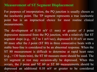 Measurement of ST Segment Displacement For purposes of interpretation, the PQ junction is usually chosen as the isoelectric point. The TP segment represents a true isoelectric point but is an impractical choice for most routine clinical measurements.  The development of 0.10 mV (1 mm) or greater of J point depression measured from the PQ junction, with a relatively flat ST segment slope (e.g., <0.7 to 1 mV/sec), depressed 0.10 mV or more 80 msec after the J point (ST 80) in three consecutive beats with a stable base­line is considered to be an abnormal response. When the ST 80 measurement is difficult to determine at rapid heart rates (e.g., >130 beats/min), the ST 60 measure­ment should be used. The ST segment at rest may occasion­ally be depressed. When this occurs, the J point and ST 60 or ST 80 measurements should be depressed an additional 0.10 mV or greater to be considered abnormal. 