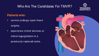 Who Are The Candidates For TMVR?
Patients who:
• cannot undergo open-heart
surgery.
• experience mitral stenosis or
mitral regurgitation in a
previously replaced valve.
 