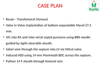 Tmvr Procedure.pdf transcatheter mitral valve implantation - TMVR.pptx