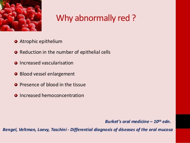 Red And White Lesions Of Oral Cavity