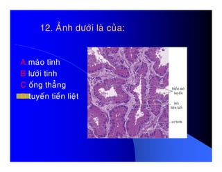 12. AÛnh döôùi laø cuûa:12. AÛnh döôùi laø cuûa:
A maøo tinh
B löôùi tinh
C oáng thaúngC oáng thaúng
D tuyeán tieàn lieät
 