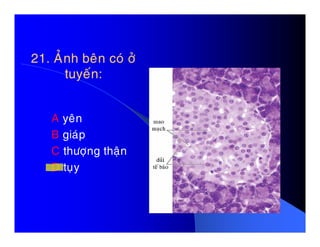 21. AÛnh beân coù ôû21. AÛnh beân coù ôû
tuyeán:tuyeán:
A yeânA yeân
B giaùp
C thöôïng thaän
D tuïy
 
