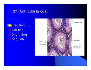 37. AÛnh döôùi laø cuûa:37. AÛnh döôùi laø cuûa:
A maøo tinh
B löôùi tinh
C oáng thaúngC oáng thaúng
D oáng tinh
 