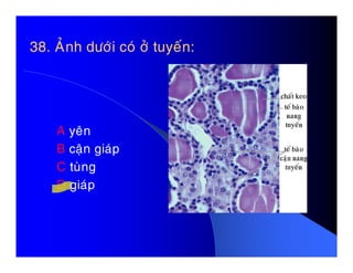 38. AÛnh döôùi coù ôû tuyeán:38. AÛnh döôùi coù ôû tuyeán:
A yeânA yeân
B caän giaùp
C tuøng
D giaùp
 
