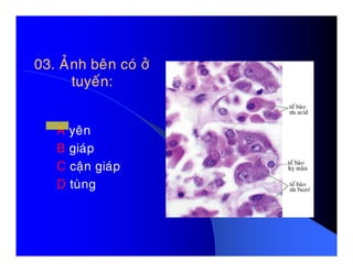 03. AÛnh beân coù ôû03. AÛnh beân coù ôû
tuyeán:tuyeán:
A yeânA yeân
B giaùp
C caän giaùp
D tuøng
 