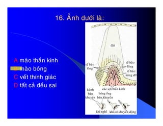 16. AÛnh döôùi laø:16. AÛnh döôùi laø:
A maøo thaàn kinhA maøo thaàn kinh
B maøo boùng
C veát thính giaùc
D taát caû ñeàu sai
 