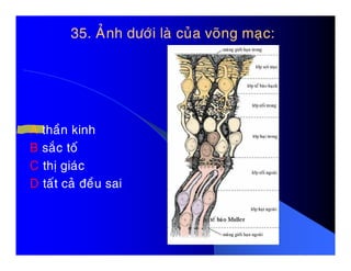 35. AÛnh döôùi laø cuûa voõng maïc:35. AÛnh döôùi laø cuûa voõng maïc:
A thaàn kinhA thaàn kinh
B saéc toá
C thò giaùc
D taát caû ñeàu sai
 