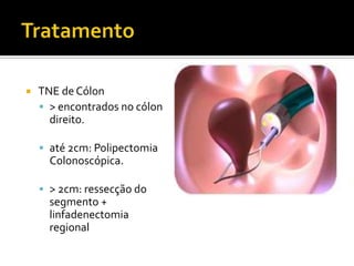    TNE de Cólon
     > encontrados no cólon
      direito.

     até 2cm: Polipectomia
      Colonoscópica.

     > 2cm: ressecção do
      segmento +
      linfadenectomia
      regional
 