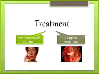 Treatment
Pharmacological
treatment
Surgical
treatment
 